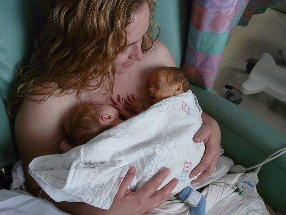 Метод кенгуру, близнецы